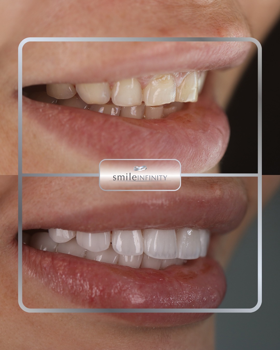 Smile Infinity&reg; Medical Center in Beirut, Lebanon &mdash; cosmetic and implant dentistry by Dr. Habib Zarifeh