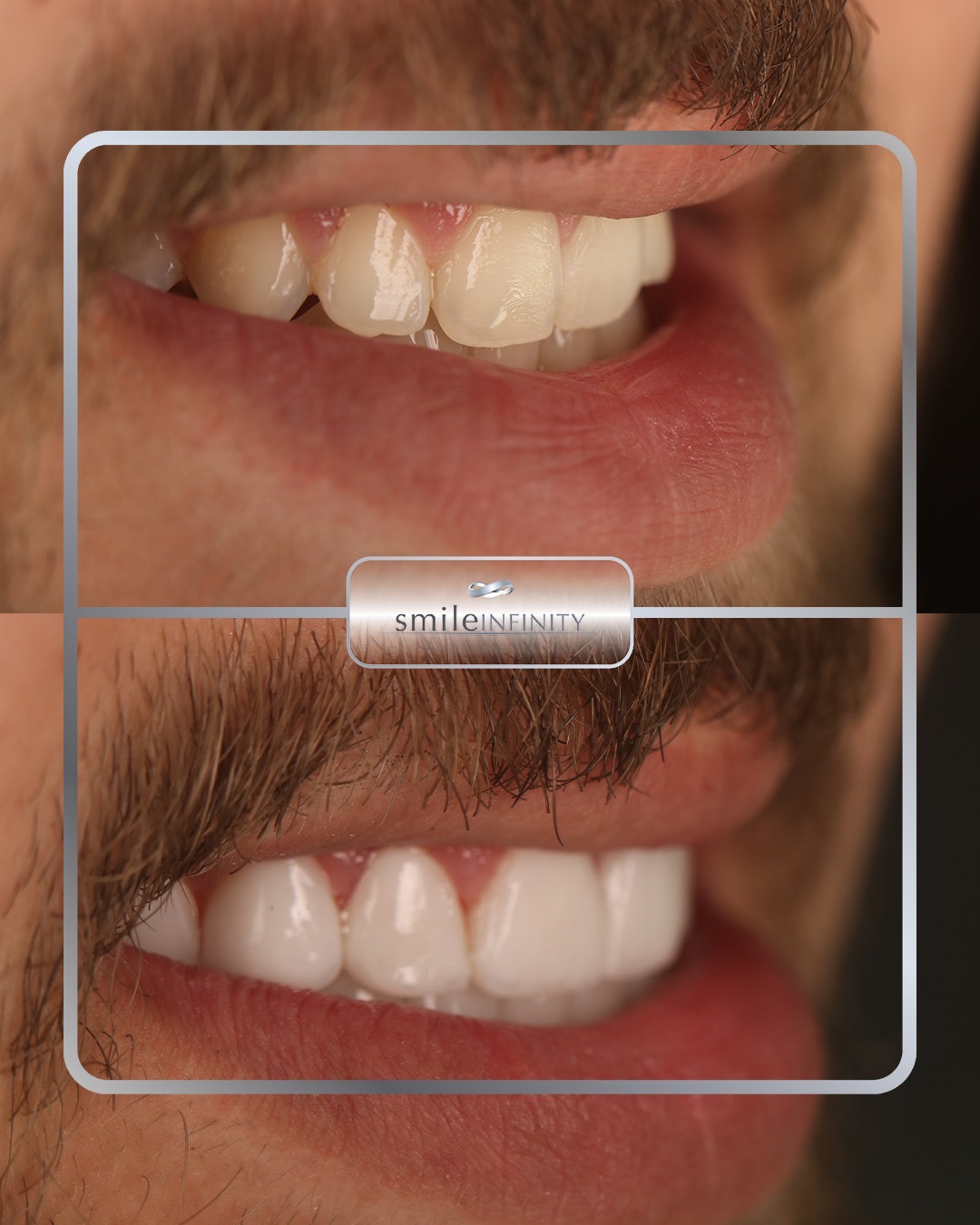 Dr. Habib Zarifeh — international laser dentistry speaker, founder of Smile Infinity&reg;, Beirut