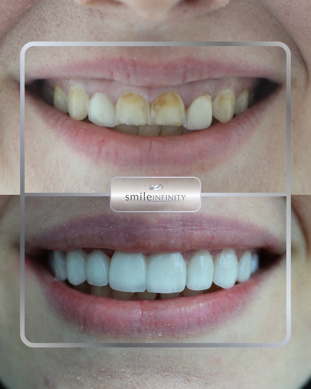 Dr. Habib Zarifeh — Head of Oral Surgery, CMC Hospital Beirut, Johns Hopkins International affiliated