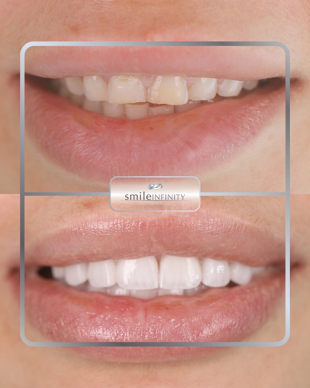 Smile Infinity&reg; Medical Center &mdash; Dr. Habib Zarifeh's cosmetic and implant dentistry clinic in Sin El Fil, Beirut, Lebanon
