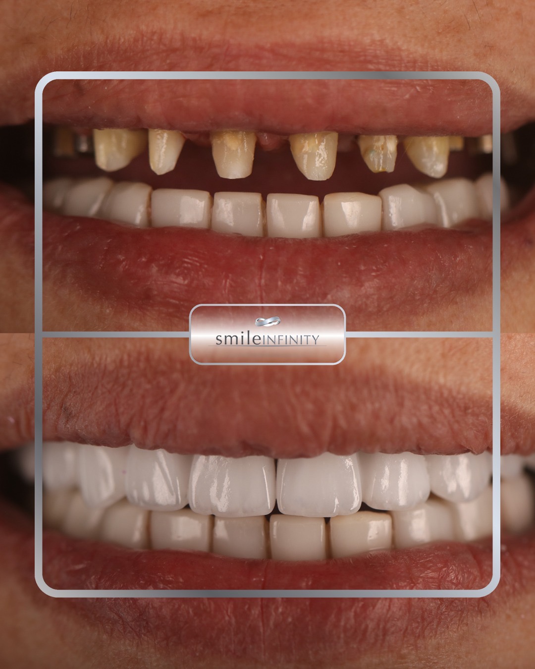 Smile Infinity&reg; &mdash; center of excellence for cosmetic and implant dentistry in Beirut, Lebanon, founded by Dr. Habib Zarifeh