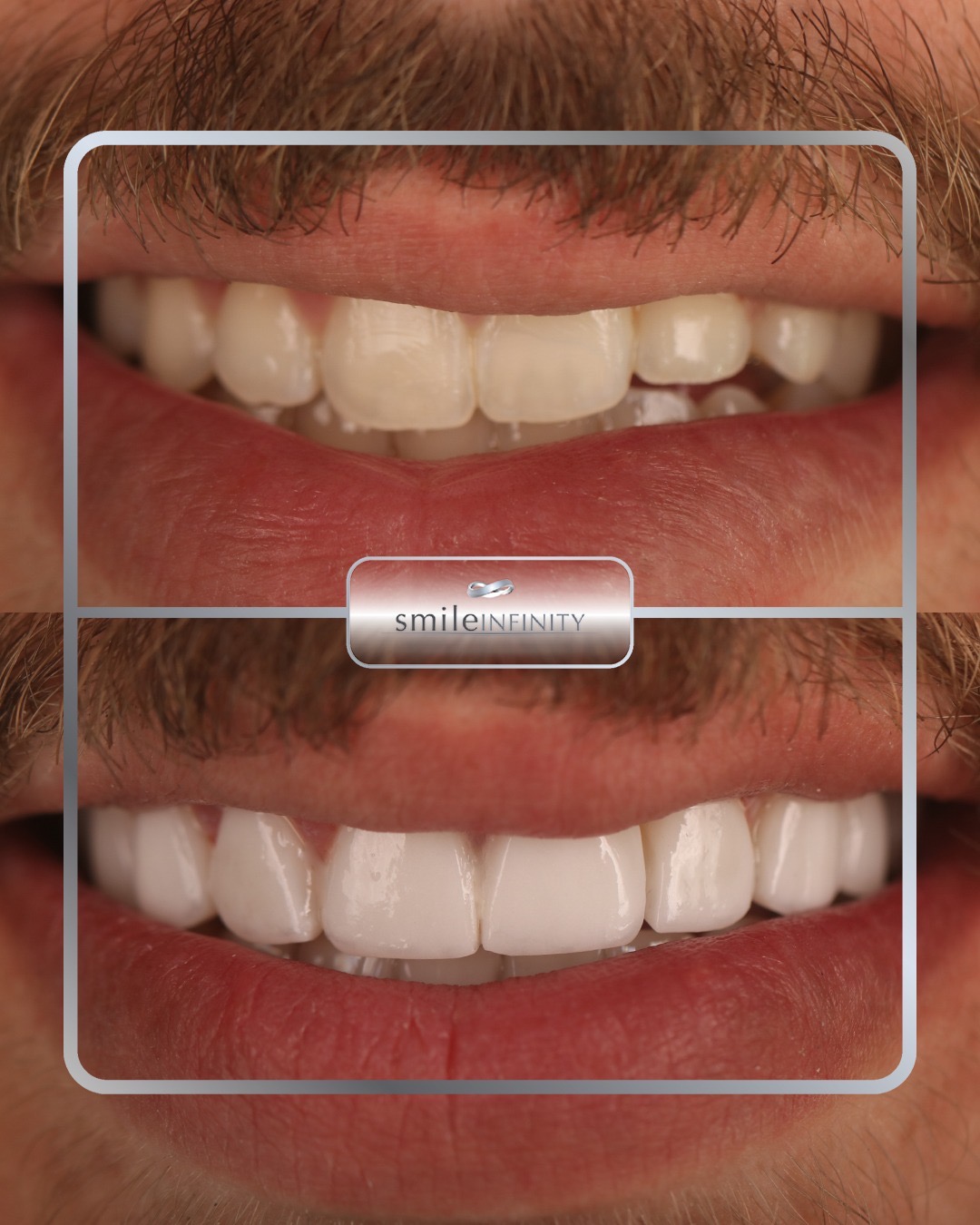 Dr. Habib Zarifeh — One Day Implant&reg; and ZEvolution Veneers&reg; specialist, Beirut, Lebanon