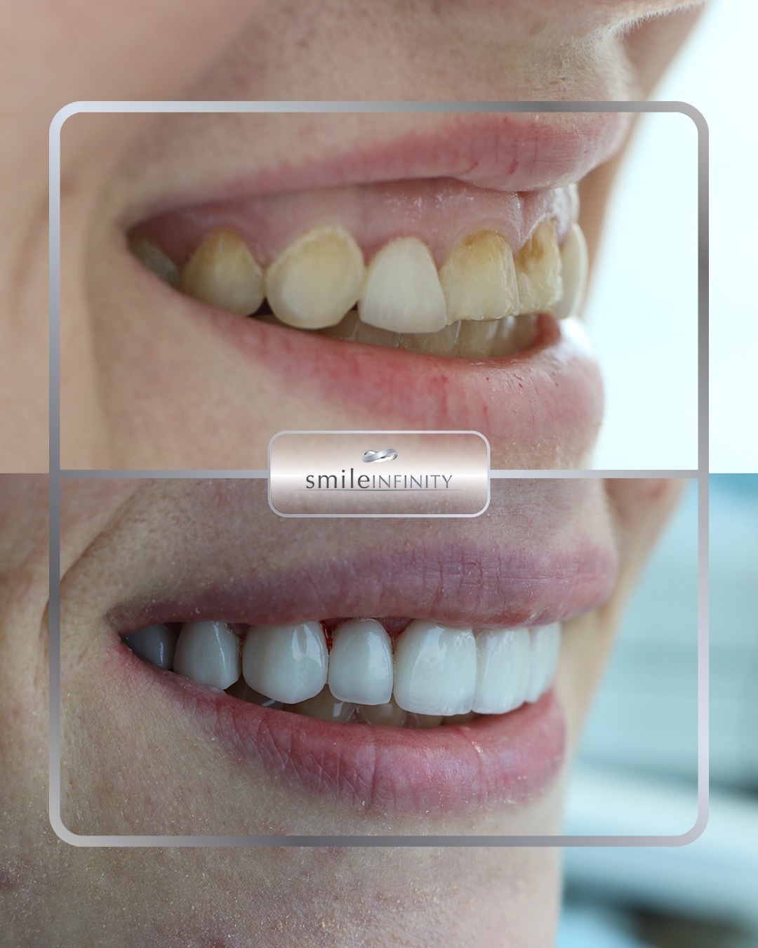 Dr. Habib Zarifeh — founder of Smile Infinity&reg;, oral surgeon and cosmetic dentist, Beirut, Lebanon